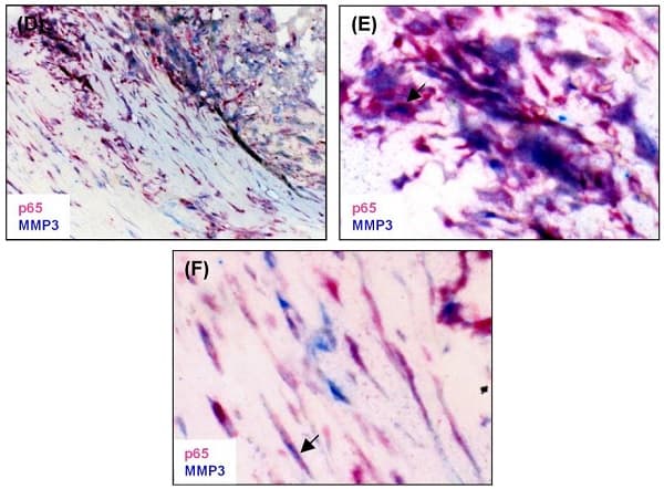 Anti-NF-kB p65 antibody [E379](AB32536)