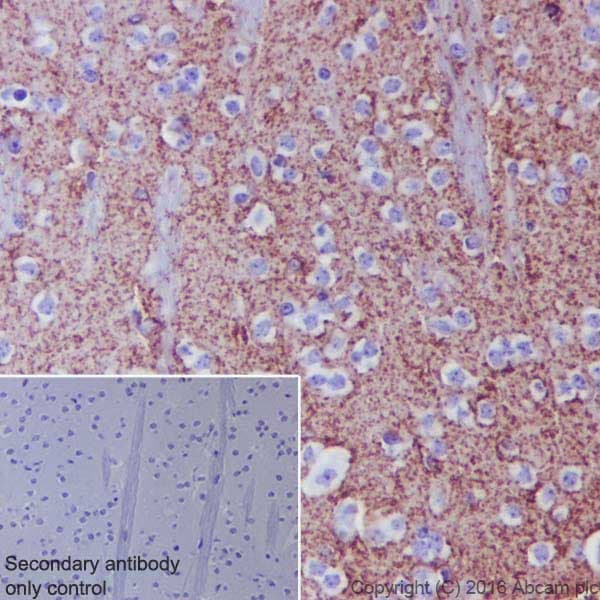 Anti-EAAT2 antibody [EPR19798] - BSA and Azide free(AB271970)
