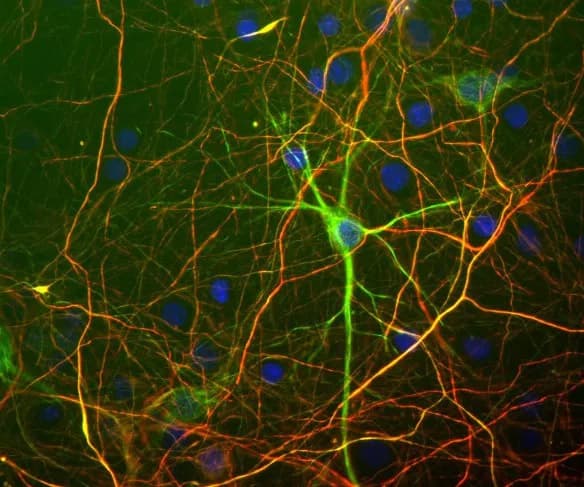 Anti-Neurofilament heavy polypeptide antibody(AB4680)