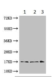 Anti-TTC11/FIS1 antibody(ab229969)
