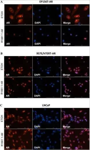 Anti-Androgen Receptor antibody [EPR1535(2)](AB133273)