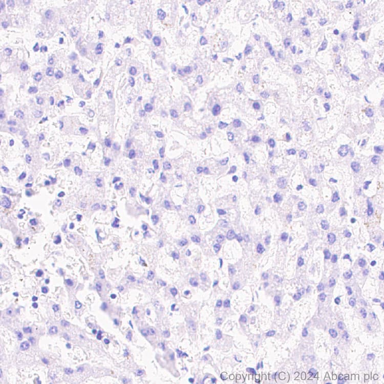 Pai1 Antibody Epr21850 262 Bsa And Azide Free Ab317605  Immunohistochemistry Formalin Pfa Fixed Paraffin Embedded Sections Img431902