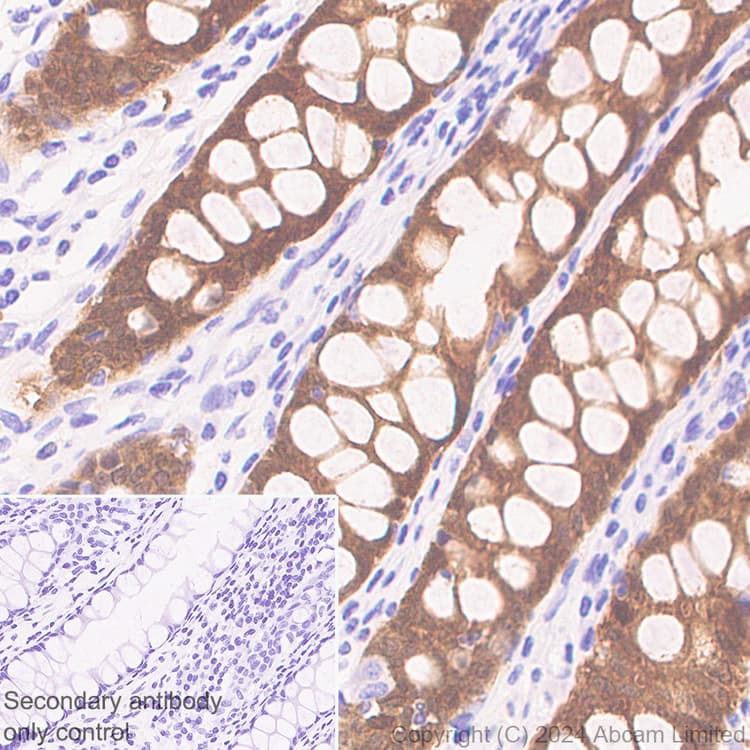 Anti-PADI2 / PAD2 antibody [EPR26940-85](ab322197)