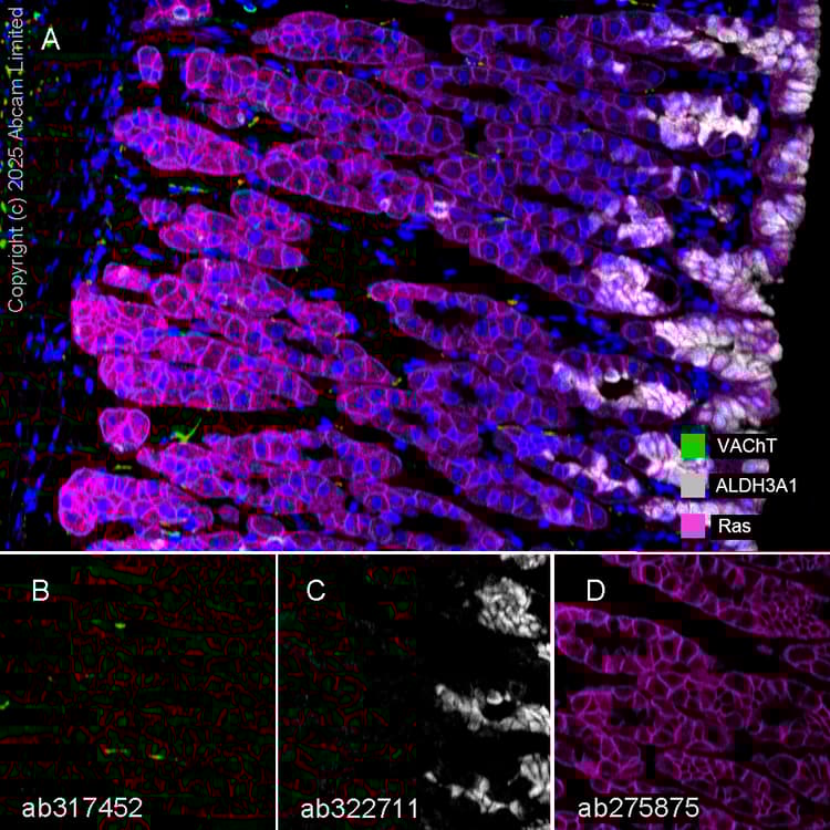 Anti-VAChT antibody [EPR29154-71](AB317452)