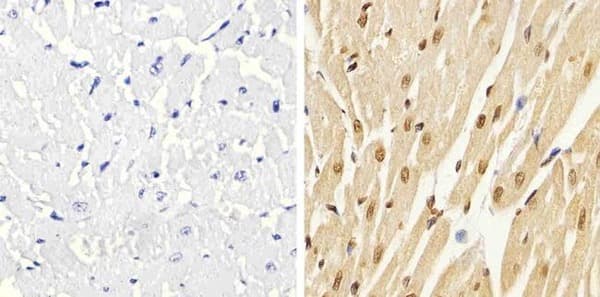 Anti-p38 (phospho T180 + Y182) antibody(AB4822)