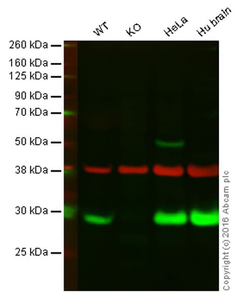 Park7 Dj1 Antibody Ab18257  Western Blot Img99399