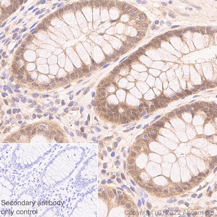 Smad2 Smad3 Antibody 18 Smad2 3 Bsa And Azide Free Ab305326  Immunohistochemistry Img406207