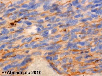 Endothelin A Receptor Et A Antibody Ab76259  Immunohistochemistry Formalin Pfa Fixed Paraffin Embedded Sections Img32740
