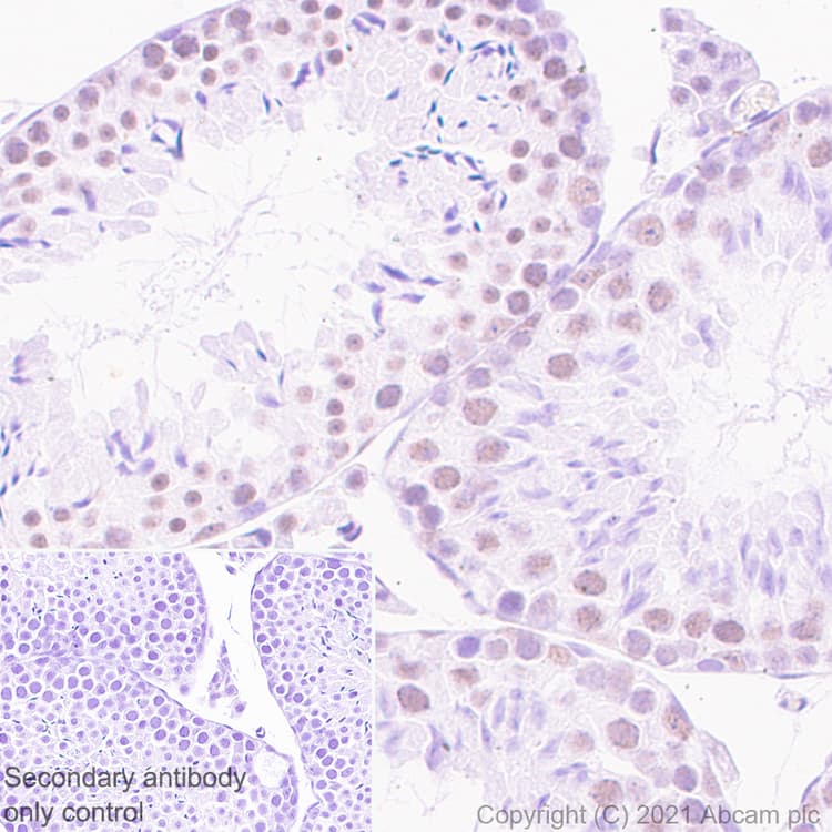 Ddx17 Antibody Epr13807b Ab180190  Immunohistochemistry Formalin Pfa Fixed Paraffin Embedded Sections Img169338