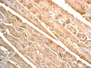 Anti-Desmin antibody [Y66] - Cytoskeleton Marker(AB32362)