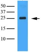 Anti-CLEC4E/MINCLE antibody [AT16E3](AB100846)