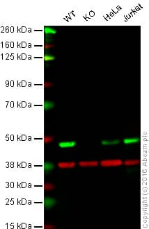 Anti-TDP43 antibody [EPR5810](AB109535)