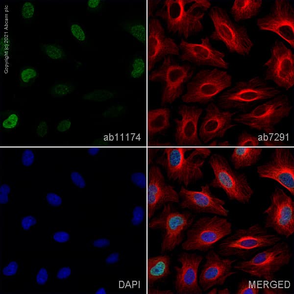 Anti-gamma H2A.X (phospho S139) antibody(AB11174)