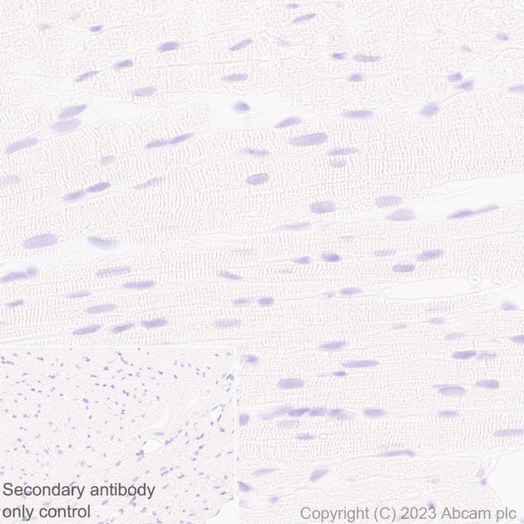 Anti-GPCR GPR17 antibody [EPR26423-34](AB316105)