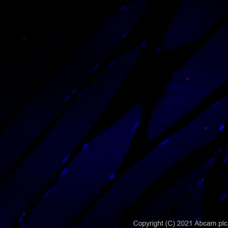 Alexa Fluor 555 Lamp2a Antibody Epr42072 Lysosome Marker Ab282009  Immunohistochemistry Formalin Pfa Fixed Paraffin Embedded Sections Img164645