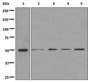 Cyp26a1 Antibody Epr11841 Ab172474  Western Blot Img112573