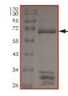 Ab204222  Sds Page Img145281