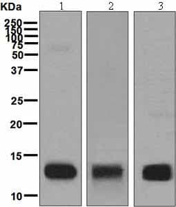 Hemoglobin Subunit Beta Hemoglobin Subunit Delta Antibody Epr8322b Ab131225  Western Blot Img107635