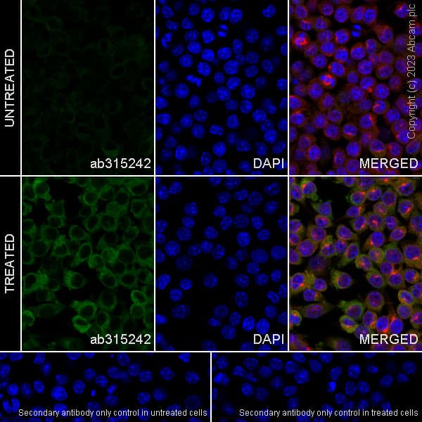Mda5 Antibody Epr28350 21 Ab315242  Immunocytochemistry Immunofluorescence Img424497