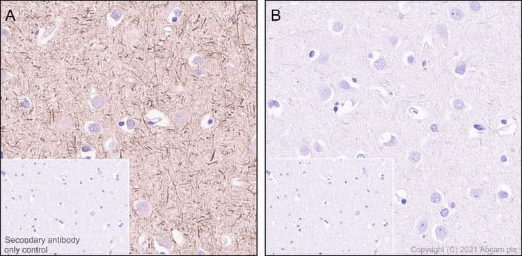 Anti-Tau (phospho S396) antibody [E178](ab32057)