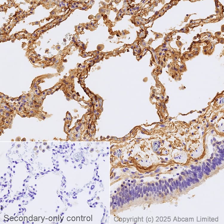 Avidin/Biotin Blocking Kit(ab64212)
