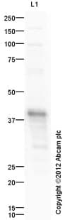 Anti-Cardiac Troponin T antibody(AB45932)