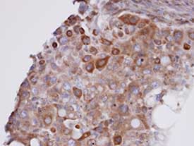 Gpx 7 Antibody Ab96257  Immunohistochemistry Formalin Pfa Fixed Paraffin Embedded Sections Img59234