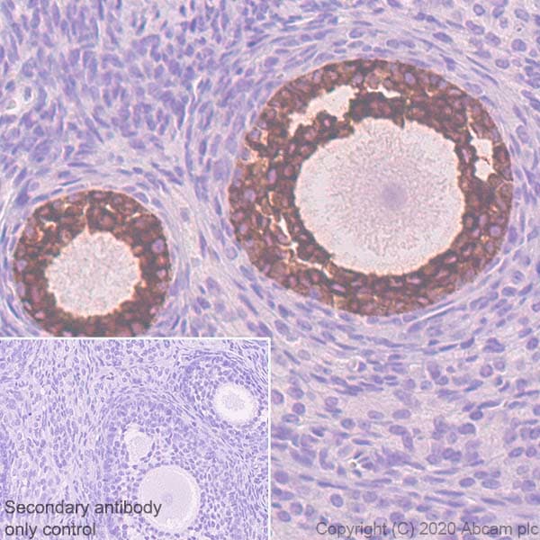 Anti-AMH antibody [EPR23380-171](AB272221)