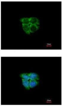 Anti-ADK antibody(AB227087)