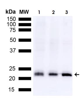 Anti-SOD2/MnSOD antibody(AB13533)