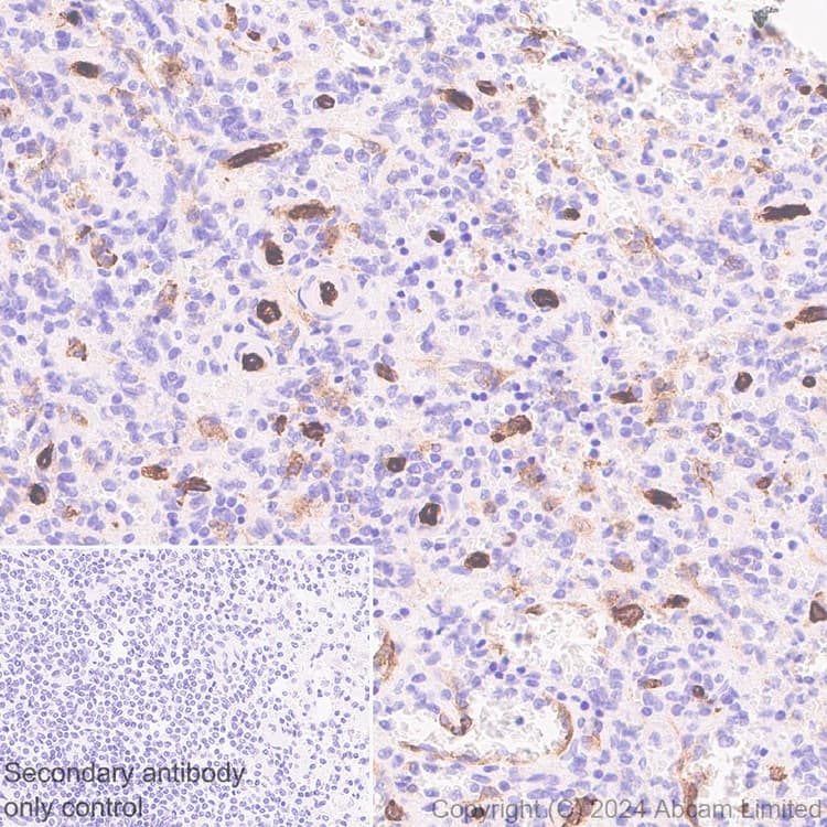 Alkaline Phosphatase Antibody Epr20428 147 Bsa And Azide Free Capture Ab252581  Immunohistochemistry Formalin Pfa Fixed Paraffin Embedded Sections Img440823