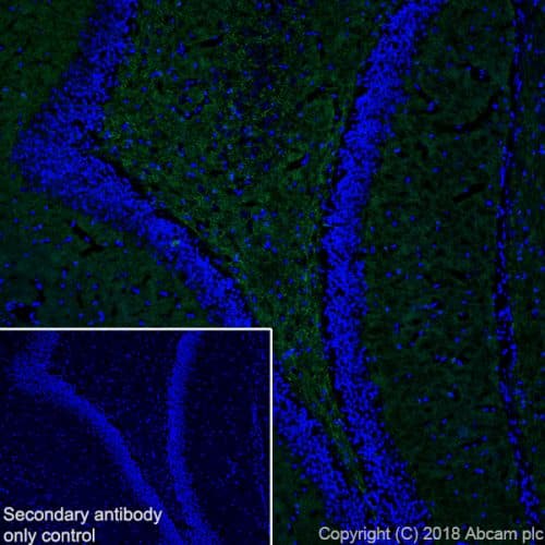 Anti-VGluT1 antibody [EPR22269](ab227805)