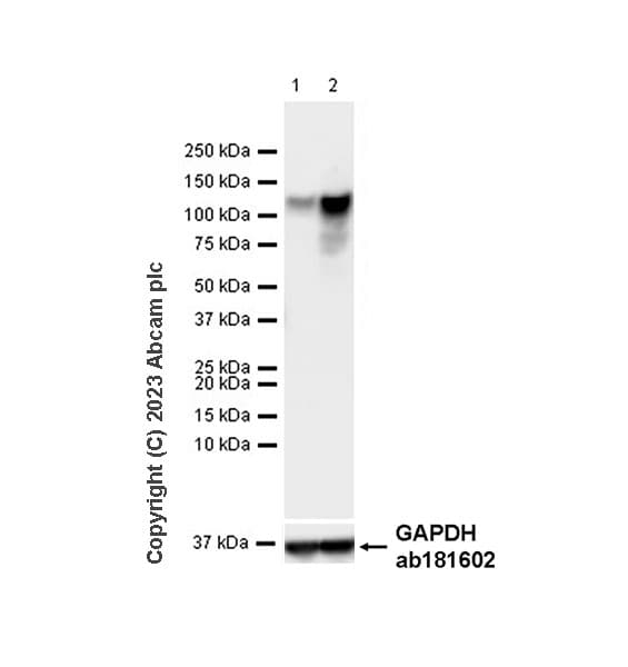 Mda5 Antibody Epr28350 21 Ab315242  Western Blot Img424419