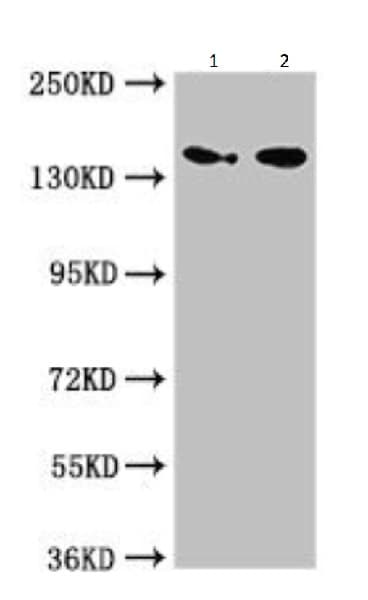 Anti-Mannosidase II/MAN2A1 antibody(ab224611)