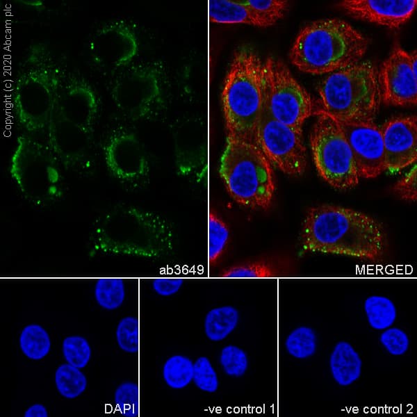 Anti-Mucin 5AC antibody [45M1](ab3649)