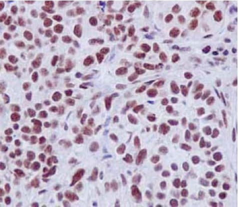 Eftud2 Antibody Epr16055b Ab188327  Immunohistochemistry Formalin Pfa Fixed Paraffin Embedded Sections Img33206