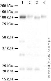 Anti-LAMP1 antibody - Lysosome Marker(AB24170)