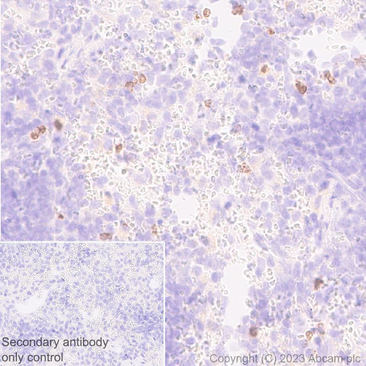 Anti-Neutrophil Elastase antibody [EPR28386-66](AB310335)