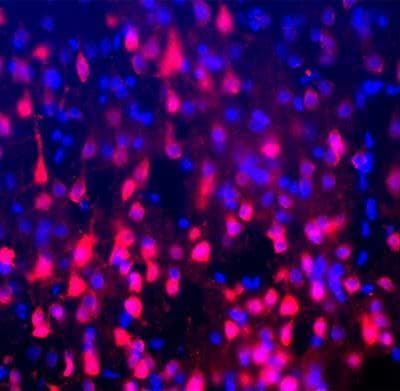 Anti-NeuN antibody - Neuronal Marker(AB104225)