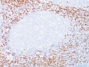 Cd8 Alpha Antibody C8 468 C8 144b Bsa And Azide Free Ab213020  Immunohistochemistry Formalin Pfa Fixed Paraffin Embedded Sections Img100770
