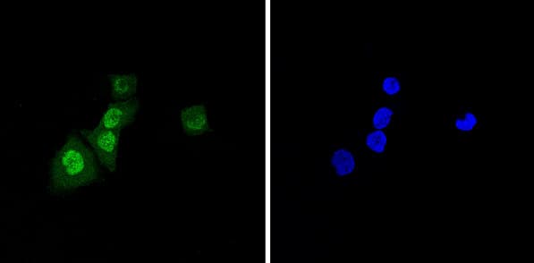 Anti-BANF1/BAF antibody [EPR7668](AB129184)