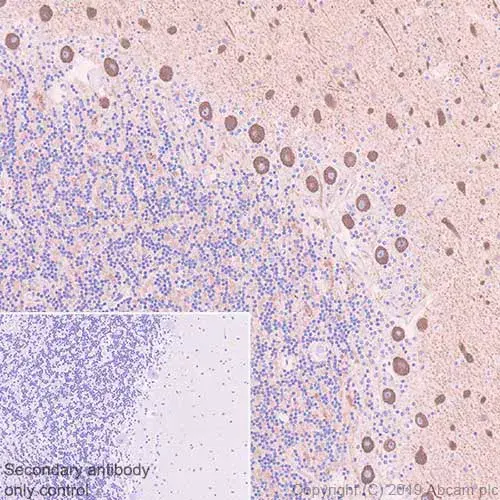 Anti-non-muscle Myosin IIB/MYH10 antibody [EPR22564-23](AB230823)