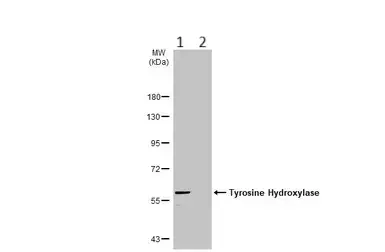 Anti-Tyrosine Hydroxylase antibody(AB137721)