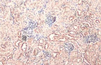 Npepps Antibody Hl1531 Ab308163  Immunohistochemistry Paraffin Embedded Sections Img407061