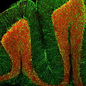 Anti-NeuN antibody - Neuronal Marker(AB104225)