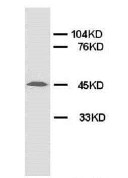Anti-RAGE antibody(AB65965)