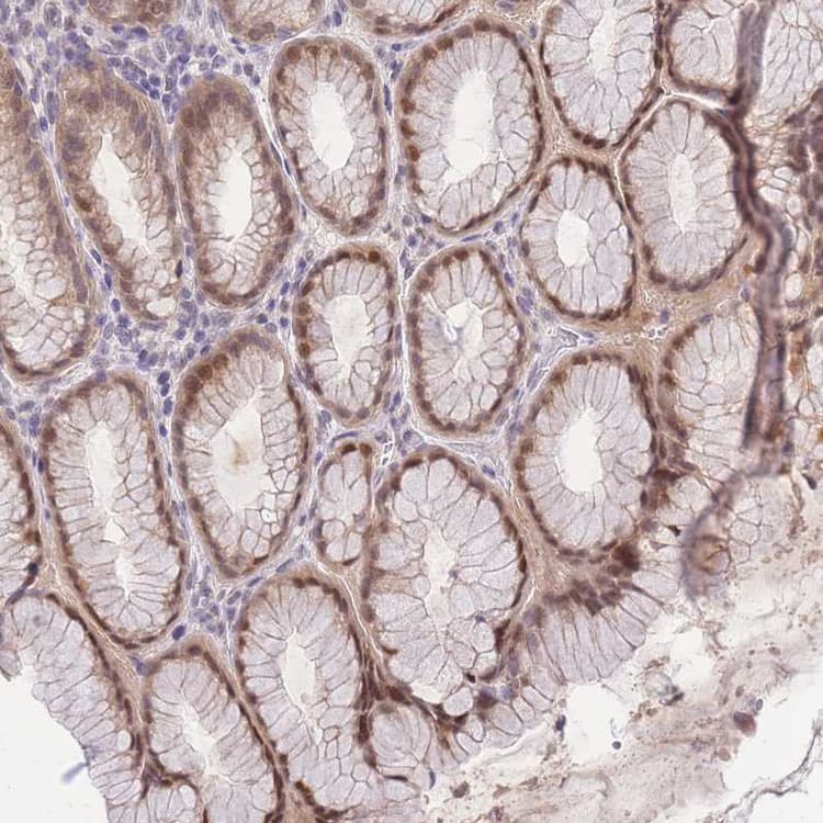 Anti-PUS10 antibody(AB185078)