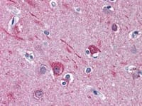 Anti-CaMKII alpha antibody(AB111890)