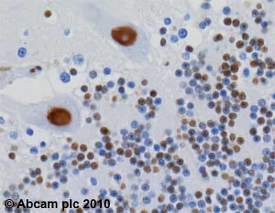 Anti-hnRNP U/p120 antibody [3G6](AB10297)