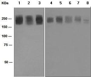 Anti-Niemann Pick C1 antibody [EPR5209](AB134113)